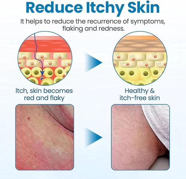 GentX Relief Cream (Pack of 2)